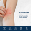 Eczema-prone skin on arm showing redness; features of soap-free, hypoallergenic body wash with low pH for sensitive, itchy skin