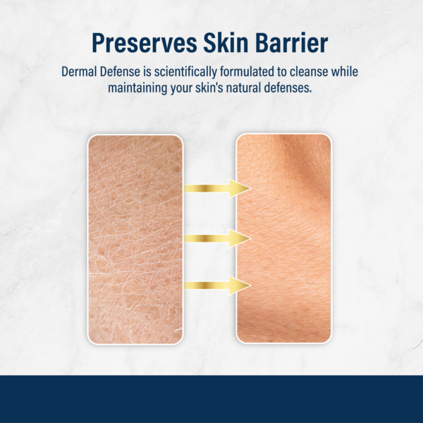 Comparison of dry and smooth skin showing results of sensitive skin cleanser that protects the skin’s natural barrier.