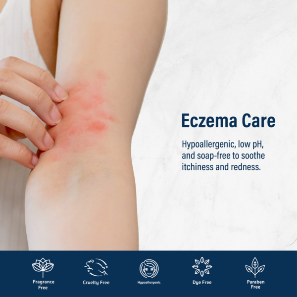 Eczema-prone skin on arm showing redness; features of soap-free, hypoallergenic body wash with low pH for sensitive, itchy skin