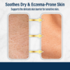 Dermal Defense by Dr. Eddie’s eczema cream restores dry, irritated skin and supports the sensitive skin barrier
