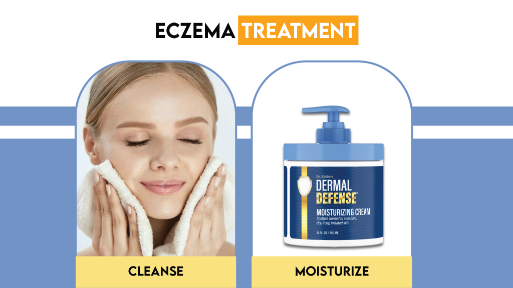 Eczema Treatment