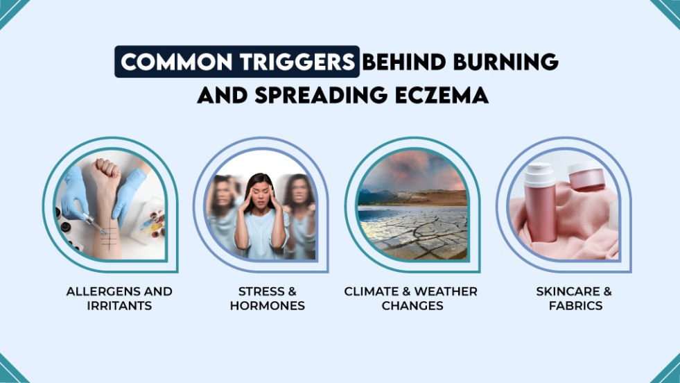 Common Triggers Behind Burning and Spreading Eczema