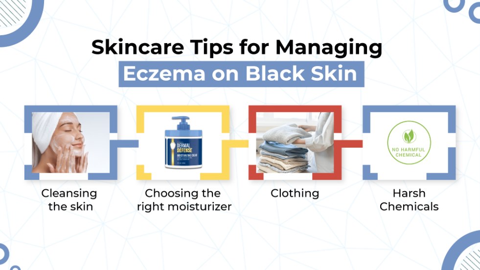 Skincare Tips for Managing Eczema on Black Skin