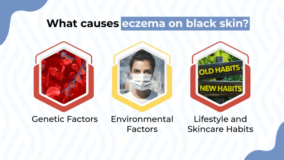 What causes eczema on black skin