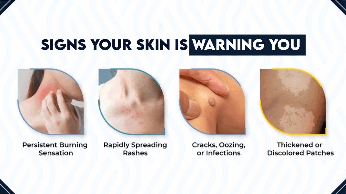 Signs Your Skin Is Warning You