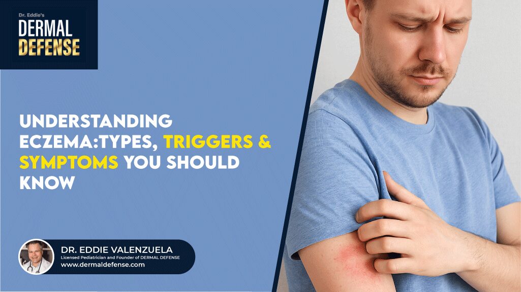 Understanding Eczema Types, Triggers & Symptoms You Should Know