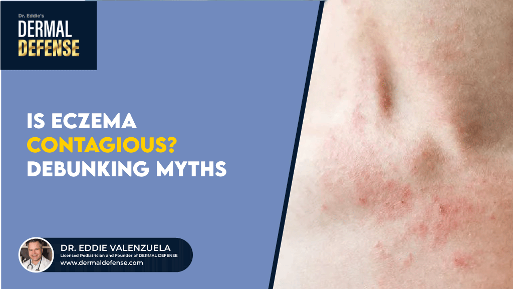 Is Eczema Contagious? Debunking Myths