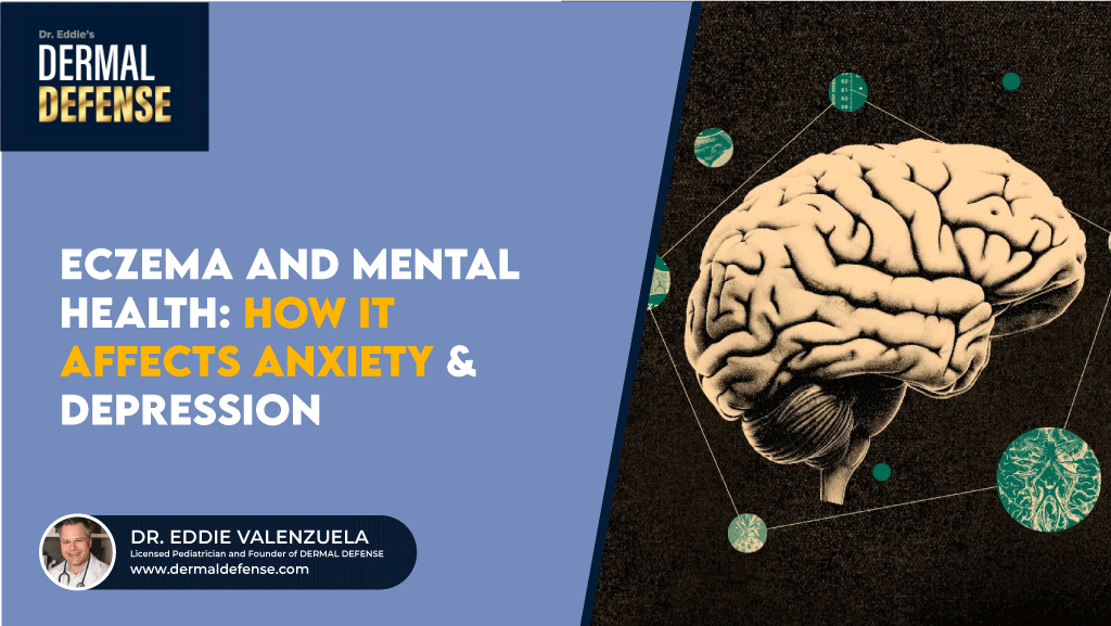 Eczema and Mental Health