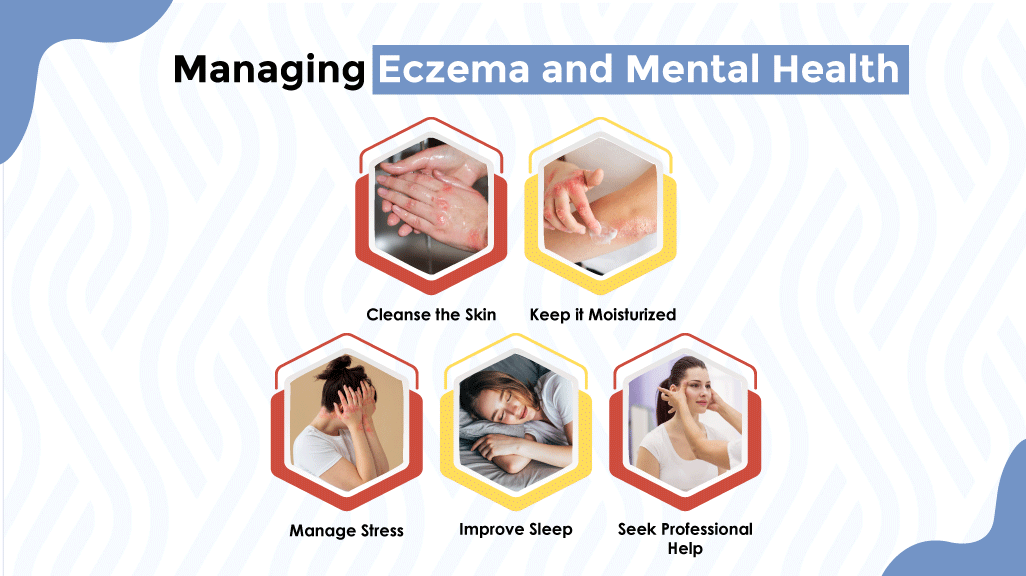 Managing Eczema and Mental Health
