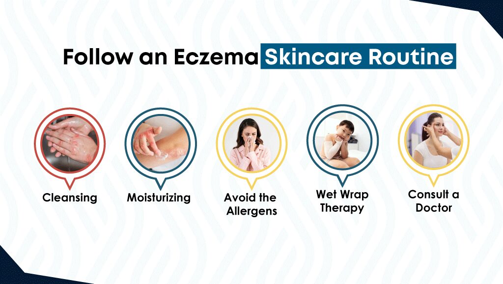 Follow an Eczema Skincare Routine 
