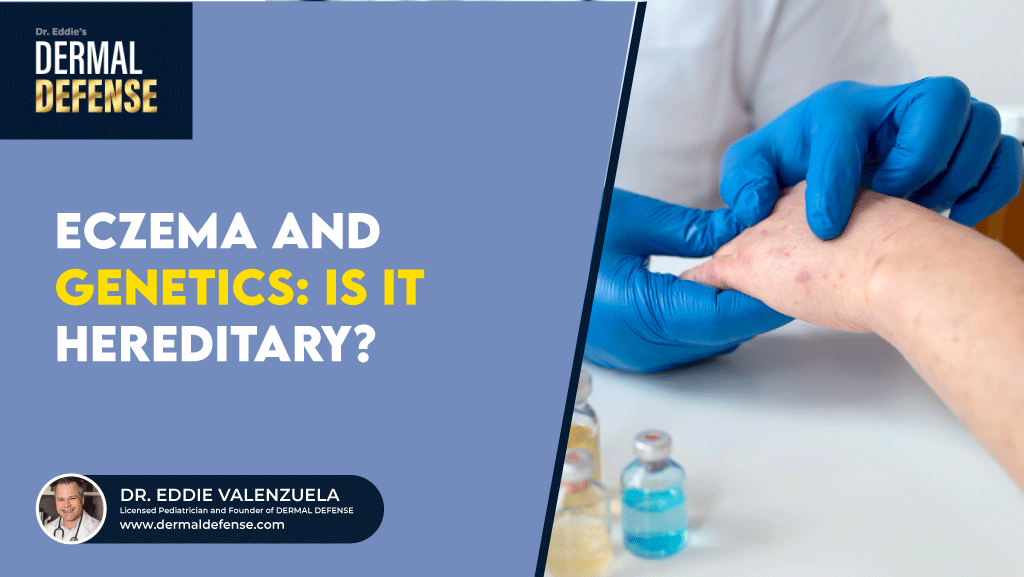 Eczema and Genetics