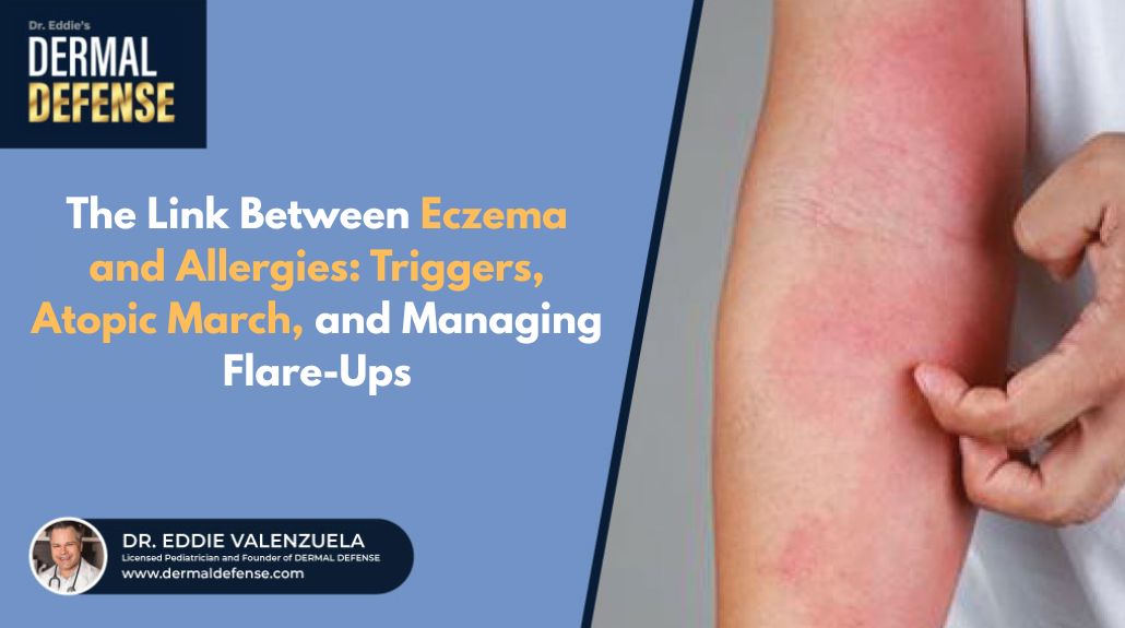 There is a strong association between eczema and allergic conditions, although researchers are still studying the exact relationship.