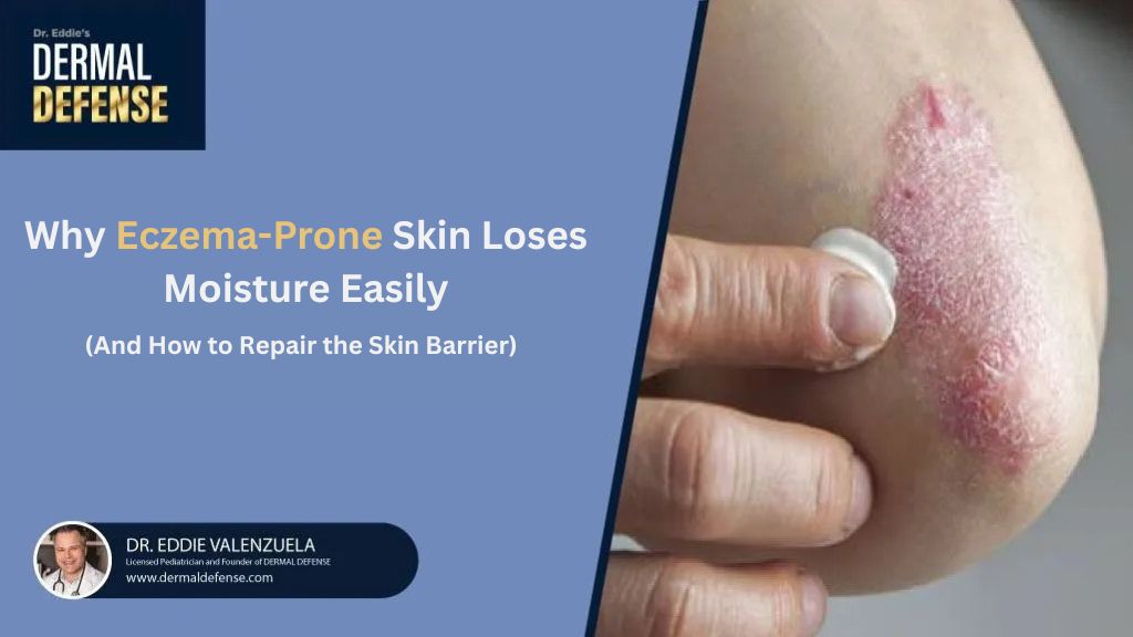 Eczema-prone skin loses moisture quickly because the skin barrier is weaker and less efficient than healthy skin.